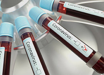 An indigenous Covid-19 testing mechanism